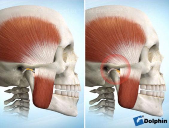 Dores na articulação mandibular diminuem com uso de laser – AUN